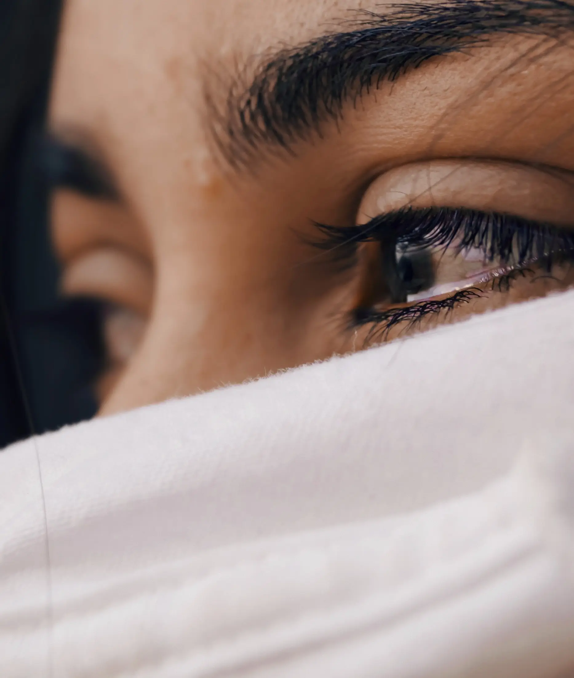 Pterygium